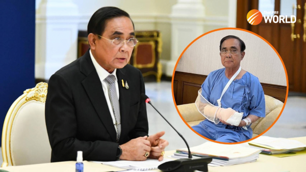 thai-pm’s-condition-improves-after-minor-surgery-on-hand
